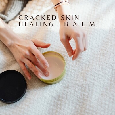 Cracked Skin Healing Balm