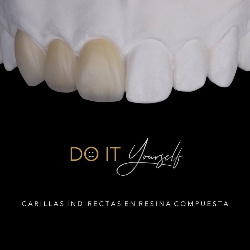 Curso DIY - Estratificación de Carillas Indirectas en Resina Compuesta