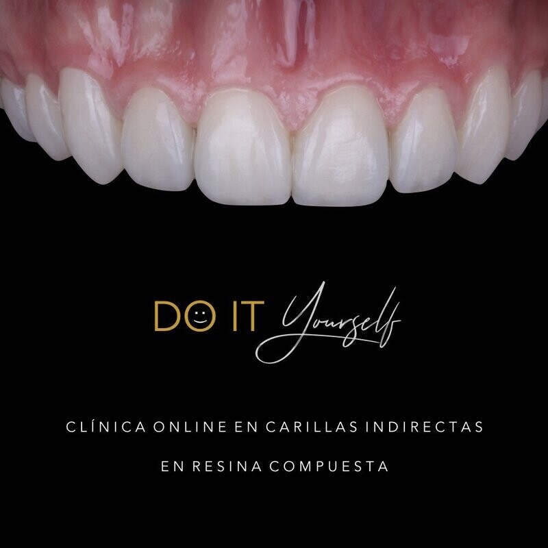 En Ingles. Curso DIY - Clínica en Encerado Diagnóstico y Carillas Indirectas de Resina Compuesta