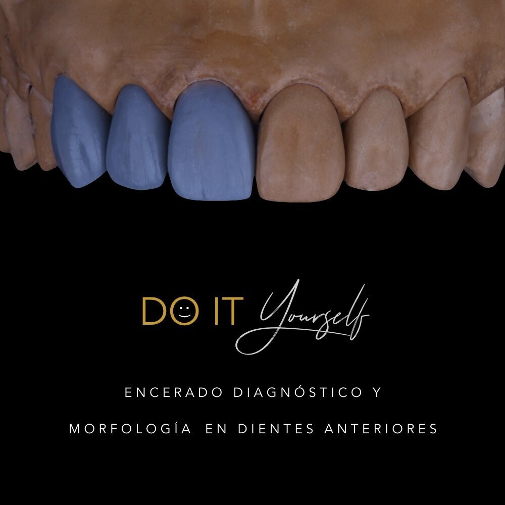 Curso DIY - Morfología dental y técnica en encerado diagnóstico