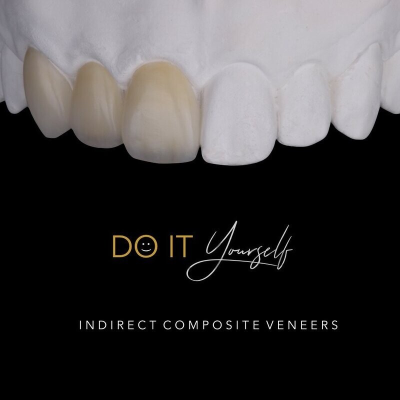 DIY Course - Layering of Indirect Composite Veneers