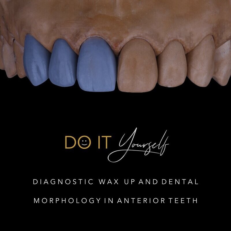 DIY Course - Dental Morphology & Diagnostic Wax-up