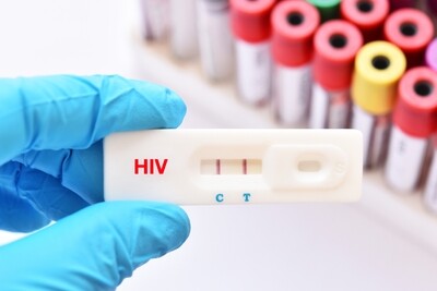 HIV RDTs