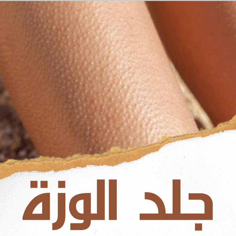 جلد الوزة
