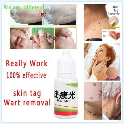 Skin Tag Remover Medical Anti-Mollen 12-Hour Quick Removal Genital Wrapping Acne Spot Treatment Anti-Foot Maize Liquid Skin care