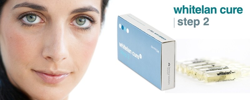 Whitelan