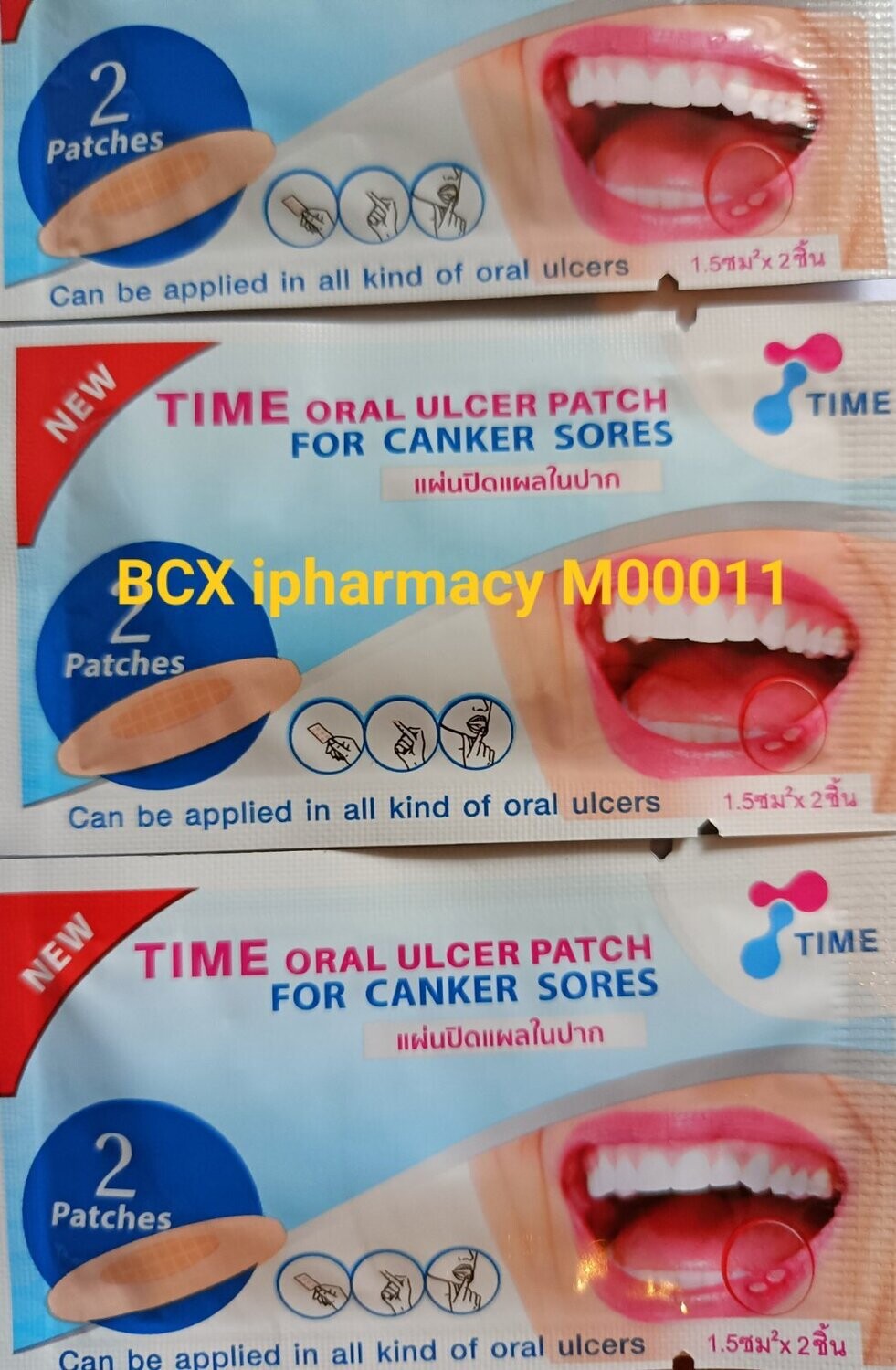 Time oral ulcer patchပါးစပ်တွင်းအနာများအတွက်ကပ်ဆေး