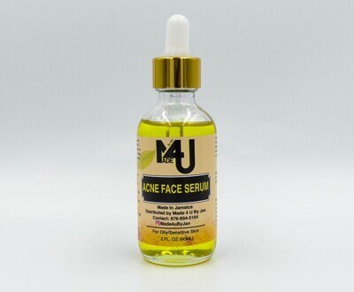 Acne Face Serum