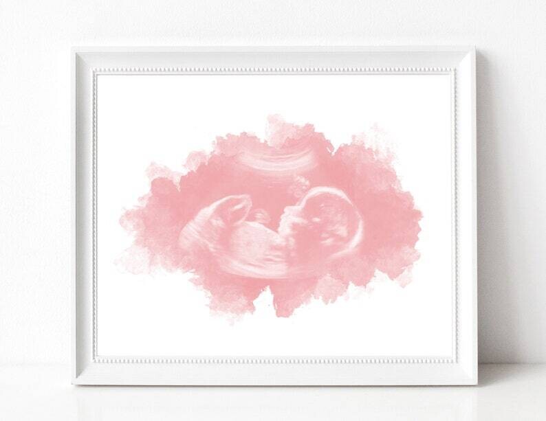 Watercolor Baby Ultrasound Print Scan Art