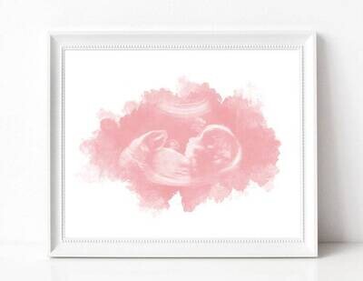 Watercolor Baby Ultrasound Print Scan Art