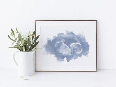 Watercolor Baby Ultrasound Print Scan Art