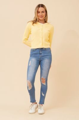 Lemon Scalloped Hem Cardigan