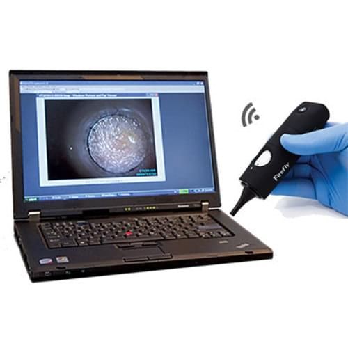 Firefly Videoscope