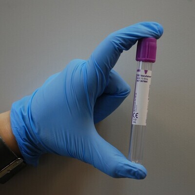 Profiles ( Liver, Cholesterol, Kidney Function )