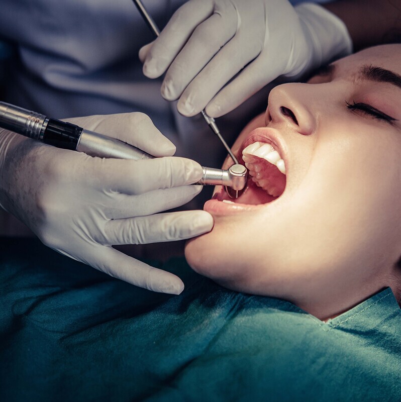 Fillings and Restorations