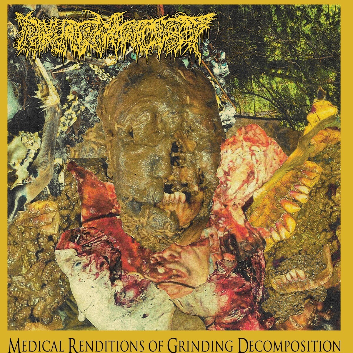 Pharmacist – Medical Renditions Of Grinding Decomposition LP (180gram Black Vinyl)