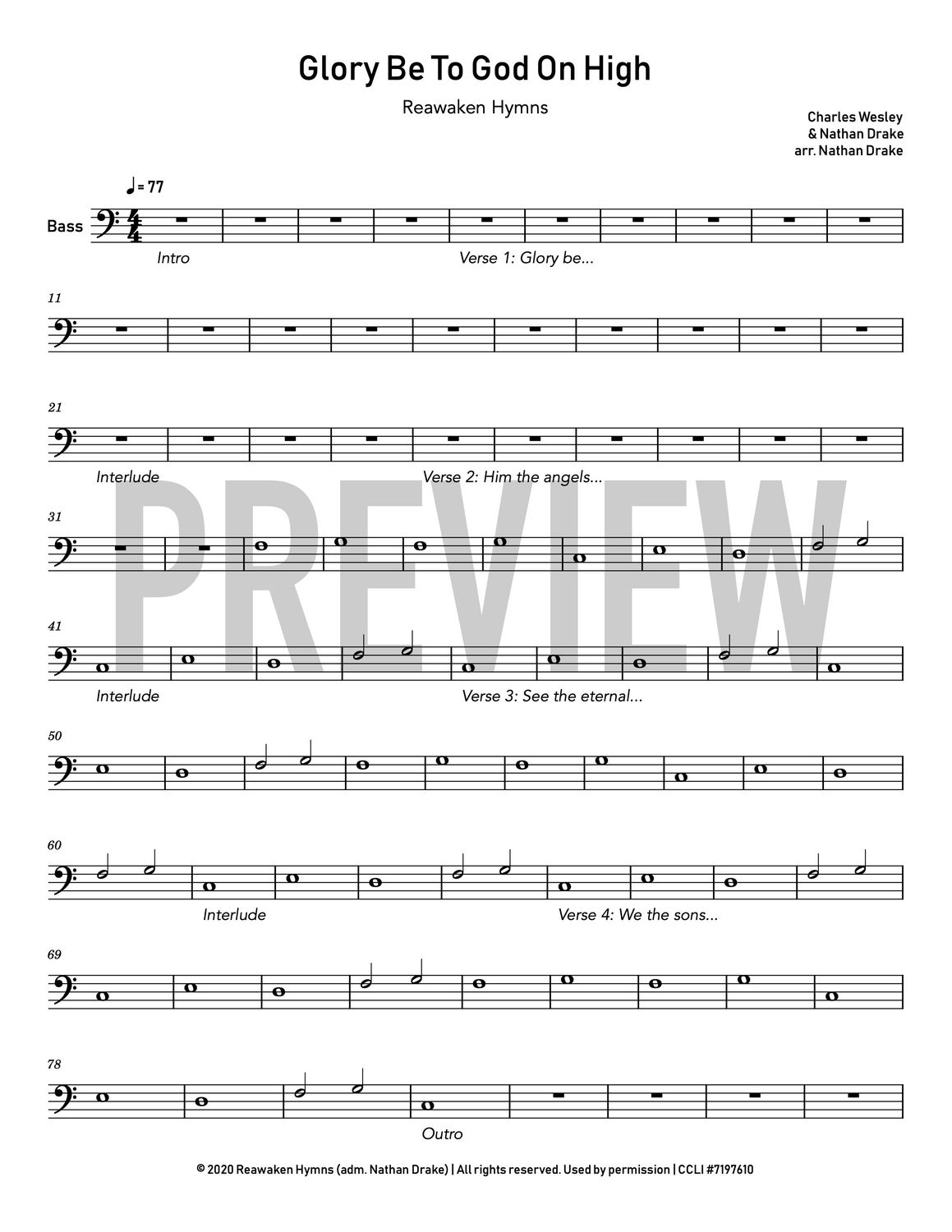 Glory Be To God On High - String Sheet Music (4 parts)