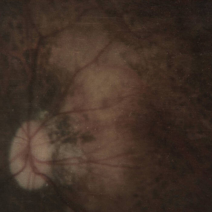 PALE SPEKTRE - Bereft of Xerotic Layers LP