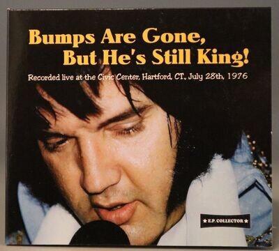 Bumps are Gone But He&#39;s Still The King