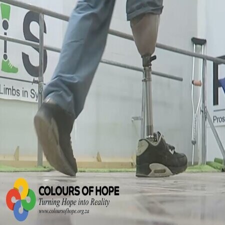 I RISE (SYRIA) PROSTHETIC LIMBS PROJECT