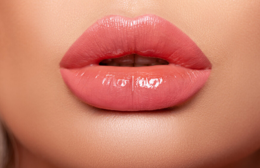 Russian lips / Aumento de labios