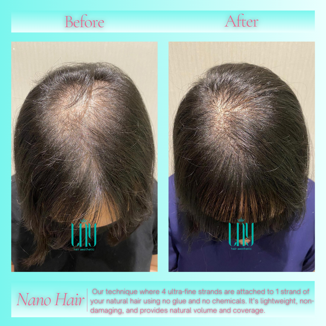 NANO HAIR RESTORATION