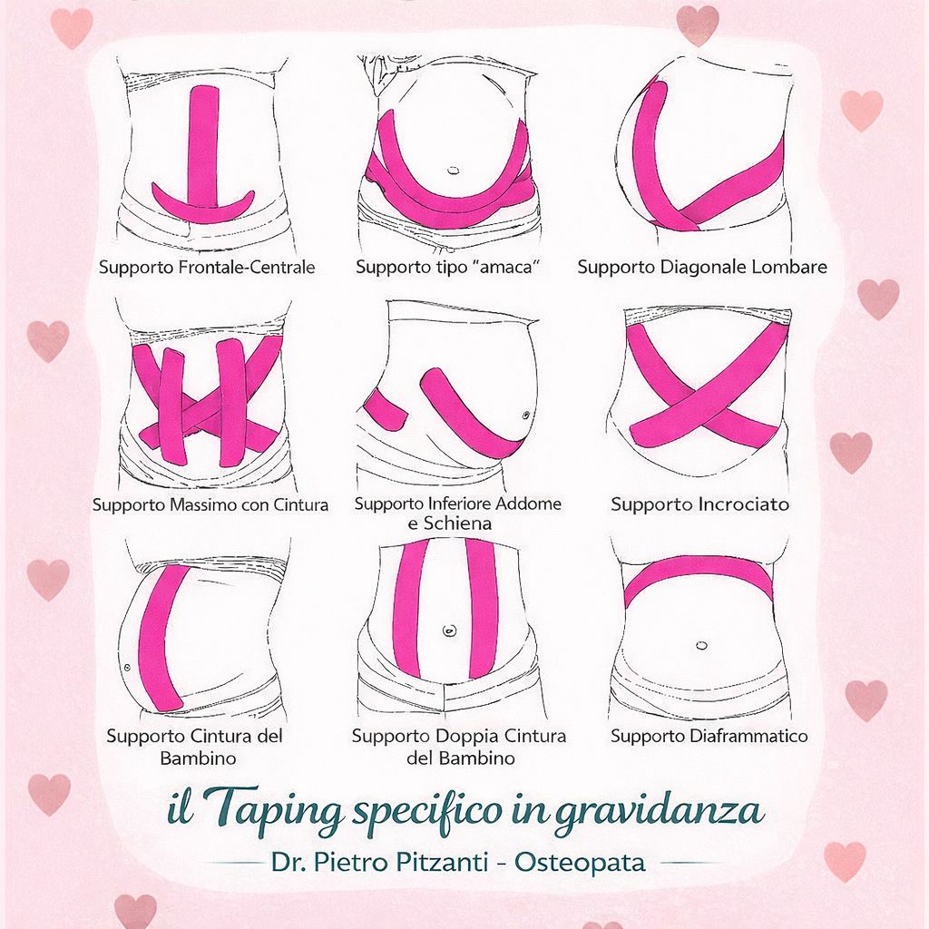 Taping in gravidanza