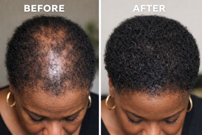 Hair Growth Treatments (Trichologist Formulated)