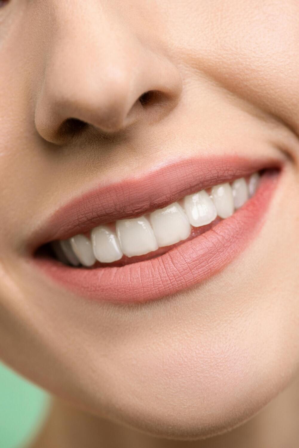 Teeth Whitening