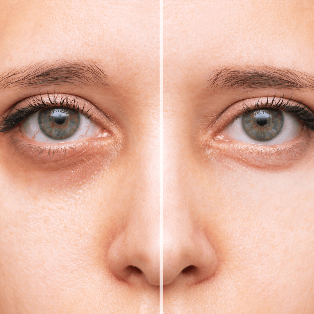Fountain of Youth Paracress Eye Woke Up Like This Caffeine + Spilanthes Under Eye Balm Stick