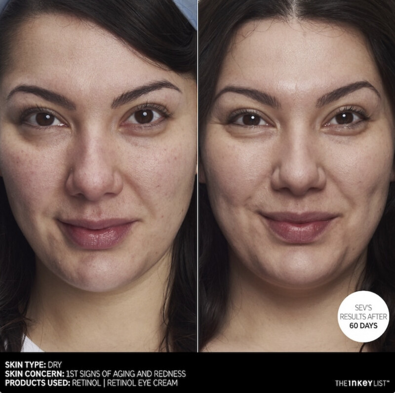 The Inkey List - Retinol Anti-Aging Serum