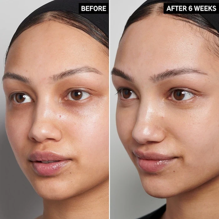 The Inkey List - 15% Vitamin C and EGF Brightening Serum