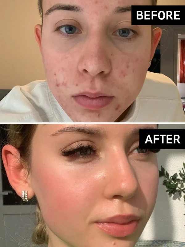 The Inkey List - Vitamin B, C, and E Moisturizer