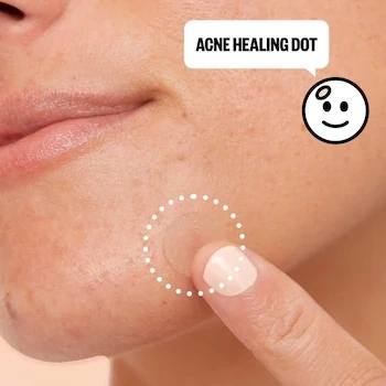 Peace Out - Acne Healing Dots | Day &amp; Night Duo