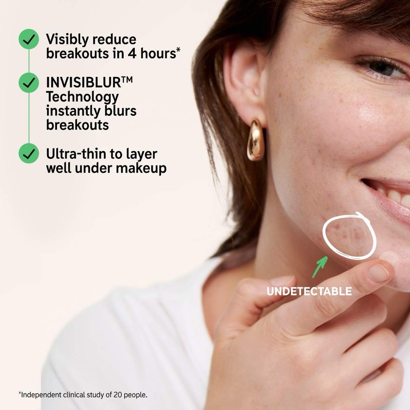 The Inkey List - Hydrocolloid Invisible Pimple Patches