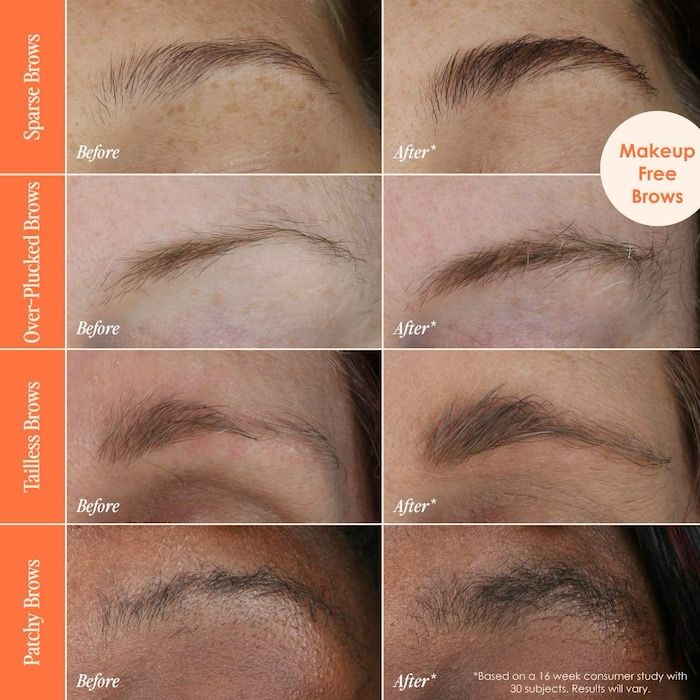Grande Cosmetics - GrandeBROW Brow Enhancing Serum | 4 Month Supply