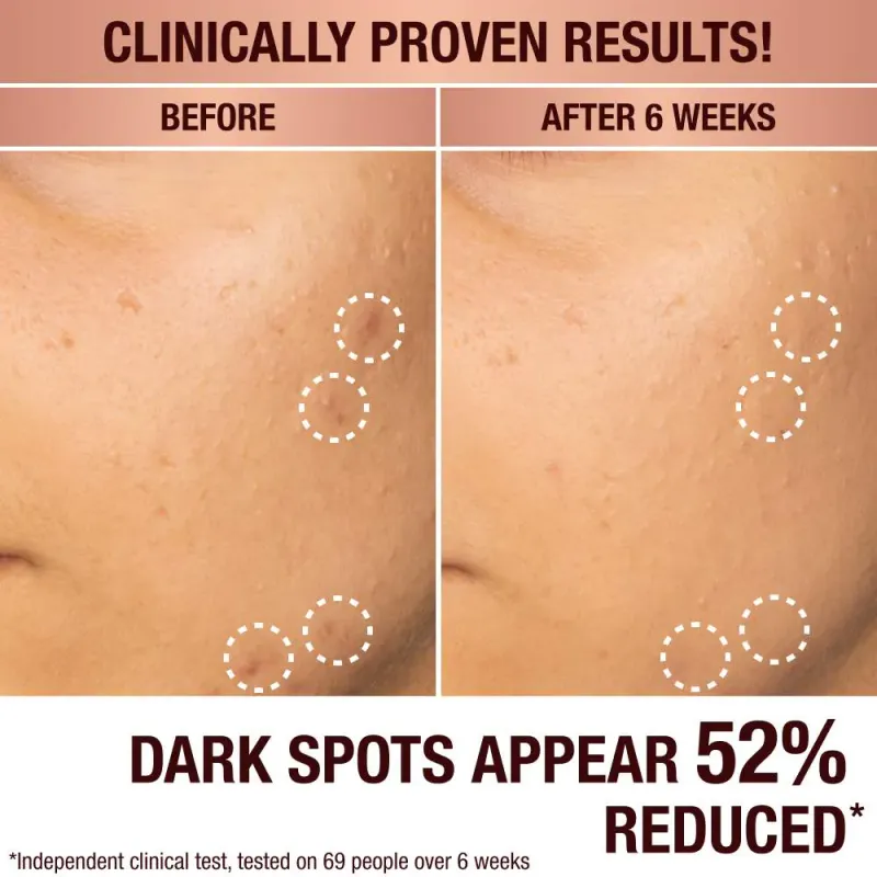 Charlotte Tilbury - Dark Spot Correcting Radiance Recovery Serum | 30 mL