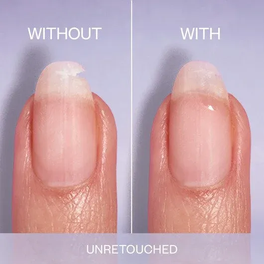 ESSIE - Break Fix Liquid Nail Patch