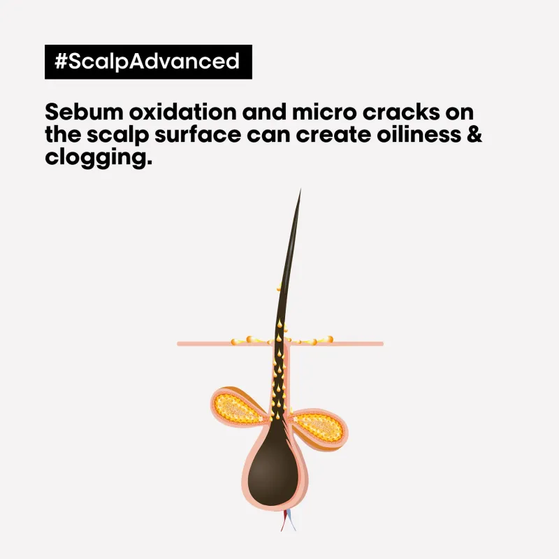L'ORÉAL PROFESSIONNEL - Scalp Advanced Anti-Oiliness Dermo-Purifier Shampoo For Oily Scalps Serie Expert | 300 mL
