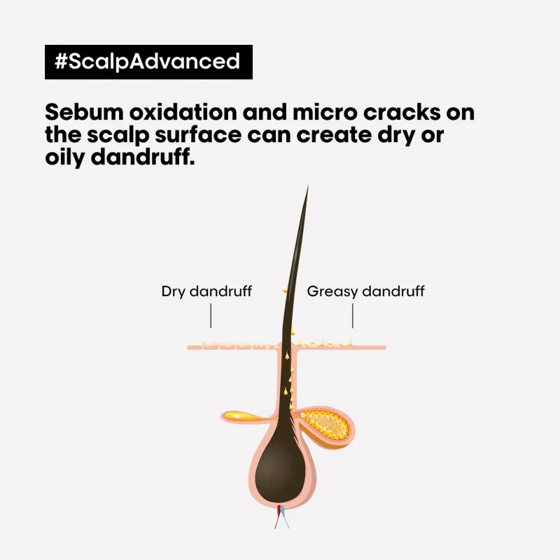 L'ORÉAL PROFESSIONNEL - Scalp Advanced Anti-Dandruff Dermo-Clarifier Shampoo For Dandruff Scalps Serie Expert | 300 mL