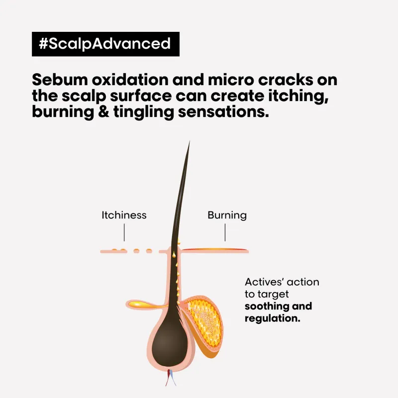 L'ORÉAL PROFESSIONNEL - Scalp Advanced Anti-Discomfort Intense Soother Treatment | For Sensitive Scalps | Serie Expert | 200 mL