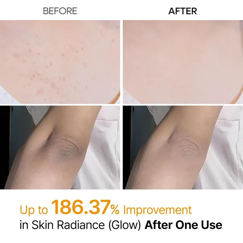 Dr. Melaxin - Peel Shot exfoliating kojic acid turmeric Spray 200 ml