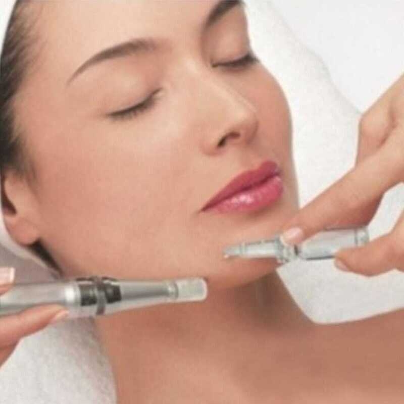 Bono de Microneedling