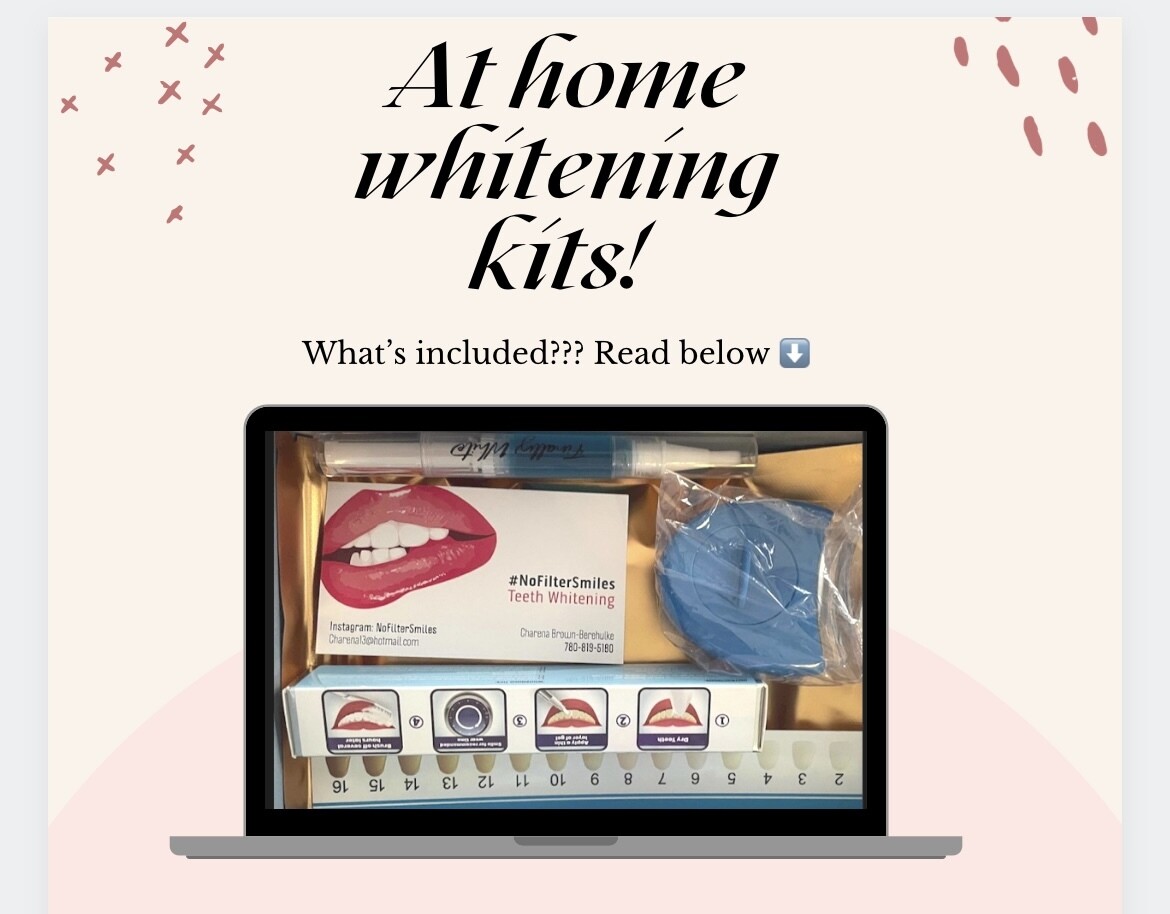 At Home Whitening Kit