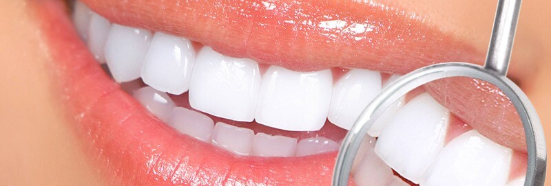 Seringue gel blanchiment dentaire américain 5ml