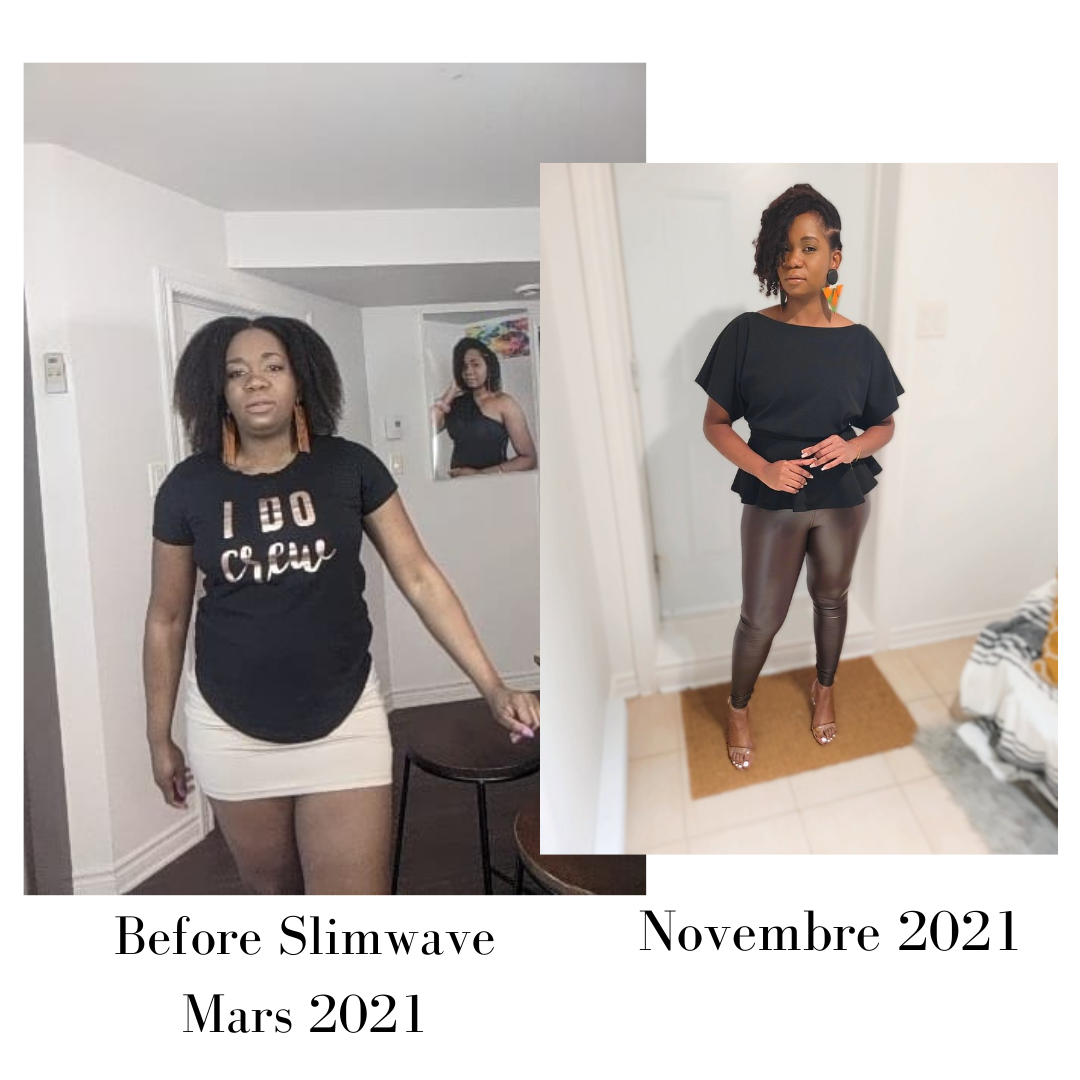 Avant - Après Slimwave et cryolipolyse
