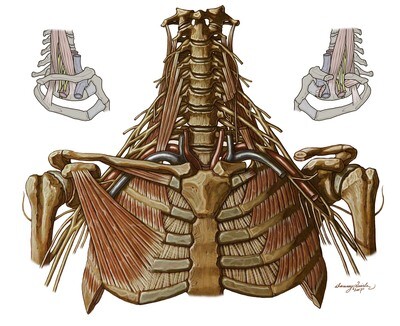 ID 5: Nerve Entrapment
