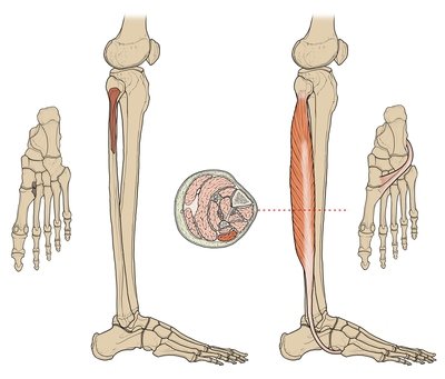 ID 2: Lower Extremity