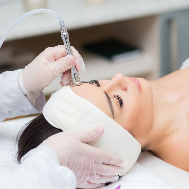 Diamond Microdermabrasion