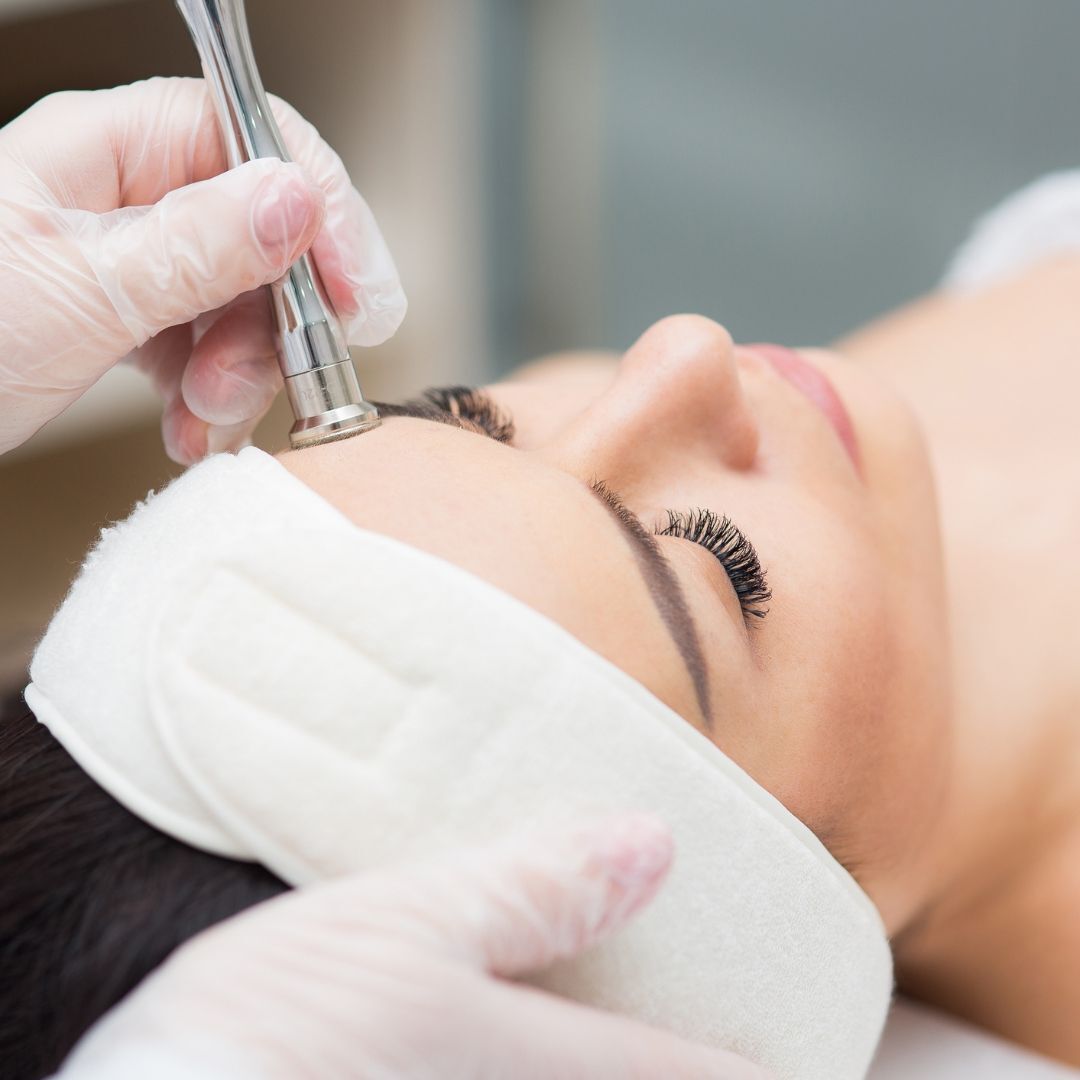 Diamond Microdermabrasion